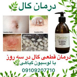 سم گال و درمان قطعی گال