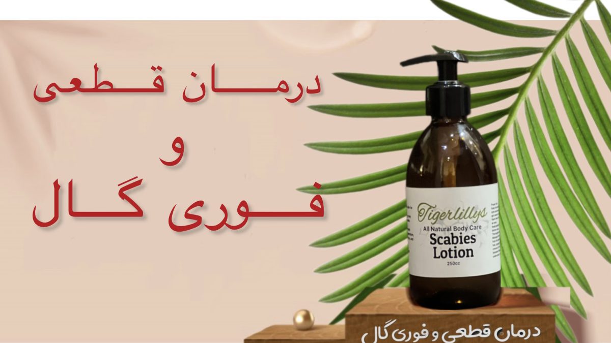 درمان گال با وازلین