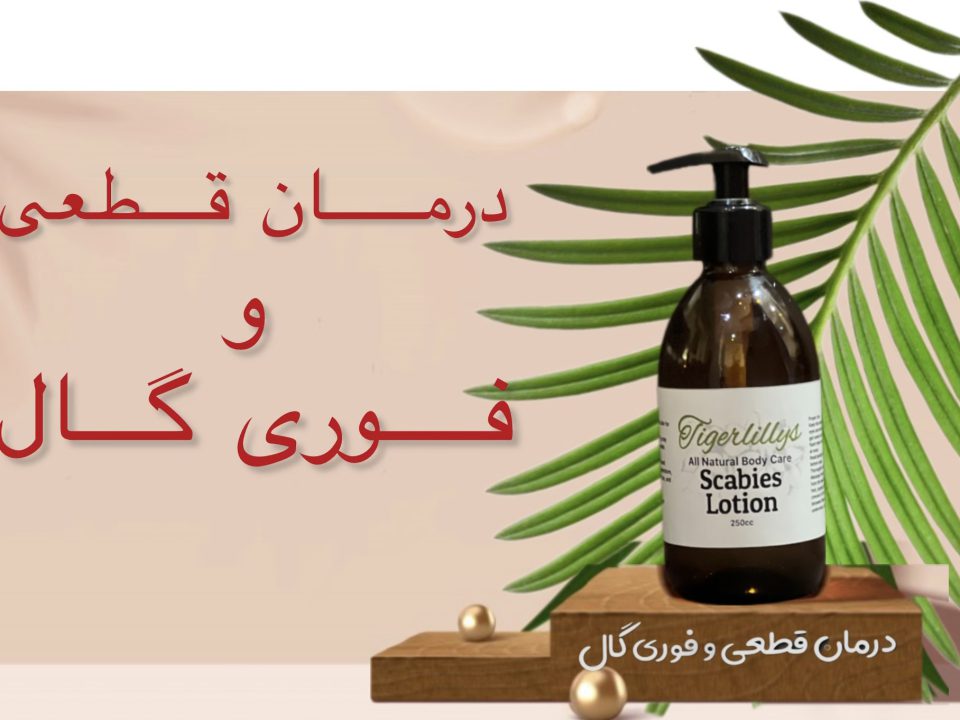 درمان گال با وازلین