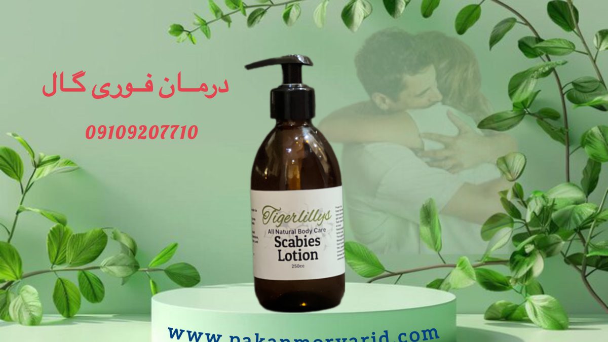 نحوه نمونه گیری گال