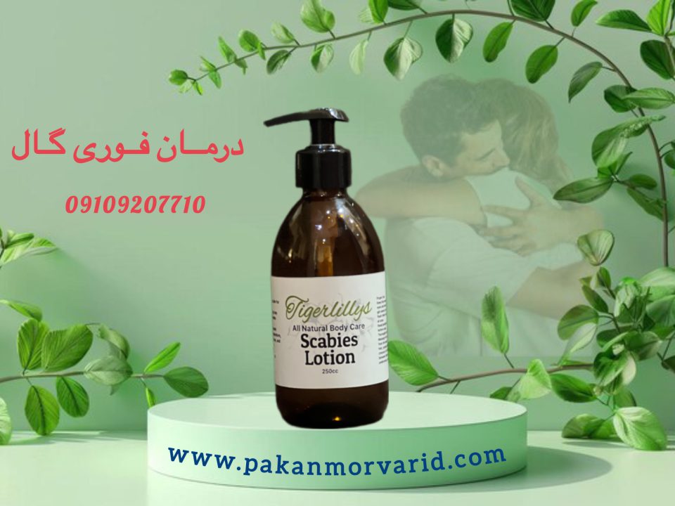 نحوه نمونه گیری گال