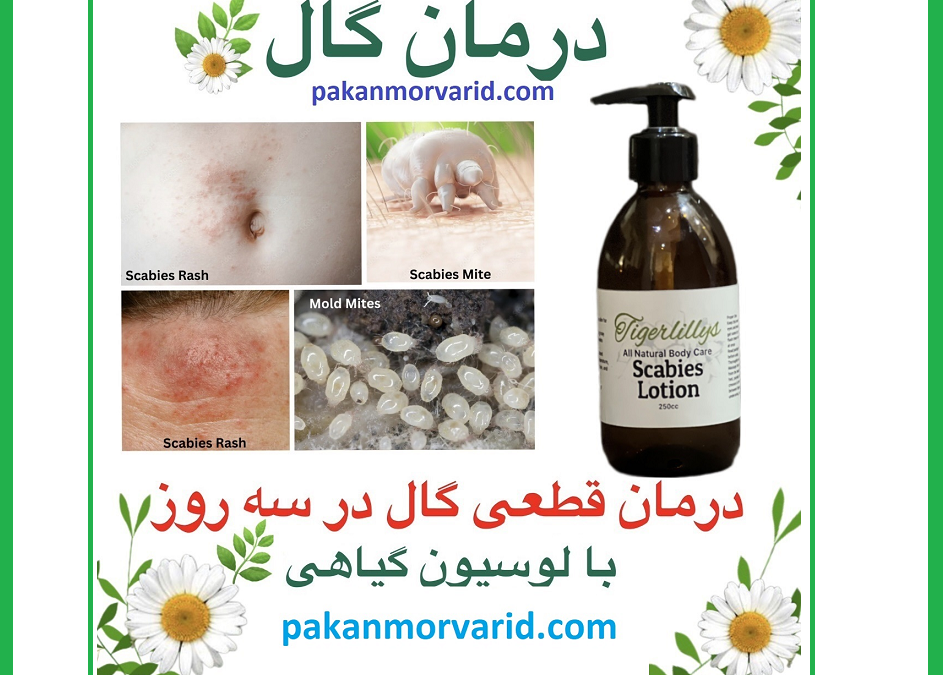 درمان گال با آمپول