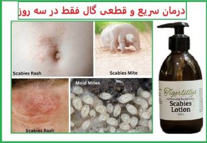 علت بیماری گال